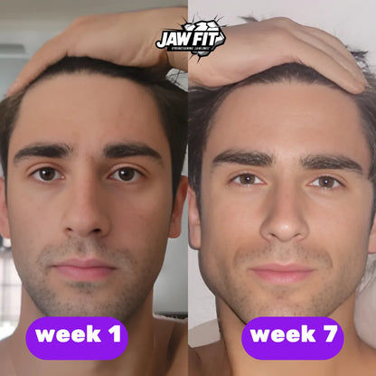 JawFit™ Trainers (Тренажори за Jawline)