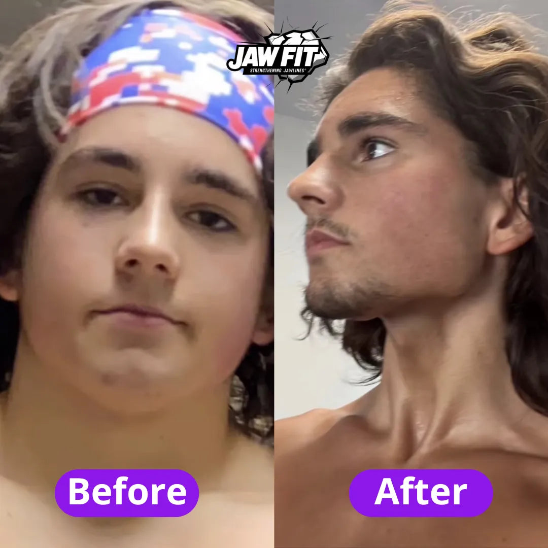 JawFit™ Trainers (Тренажори за Jawline)