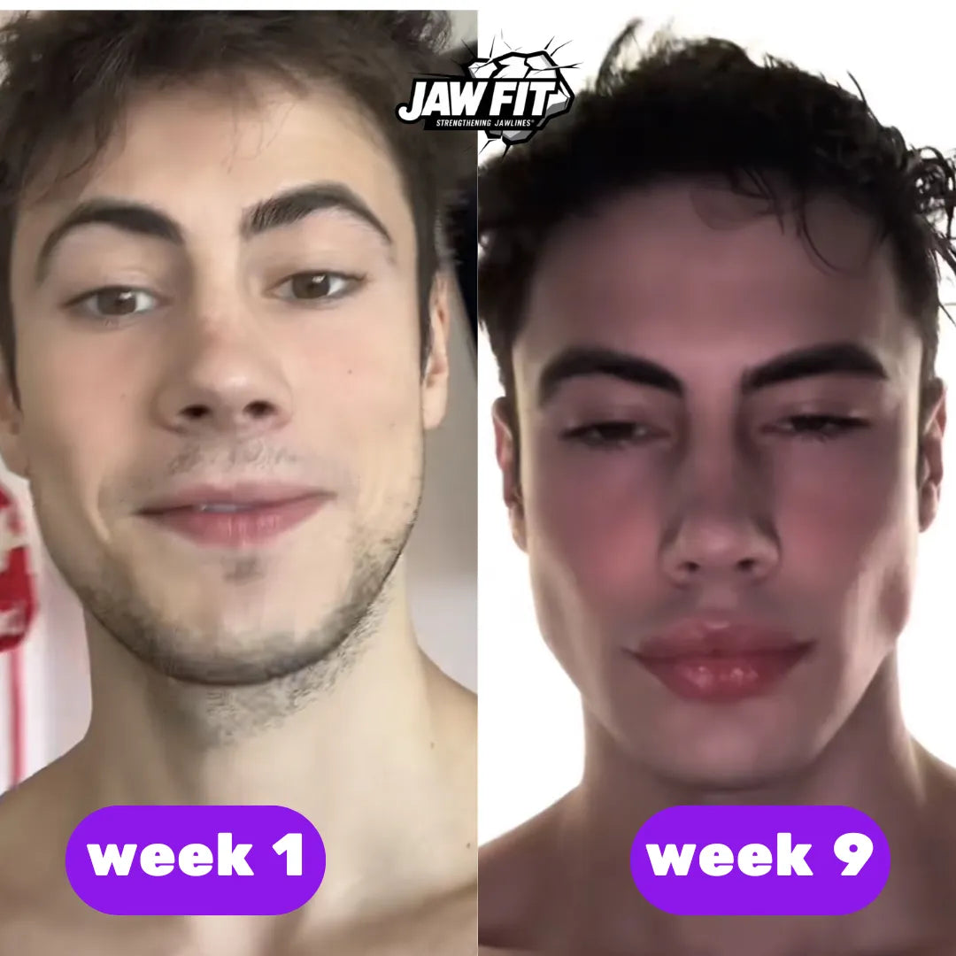 JawFit™ Trainers (Тренажори за Jawline)